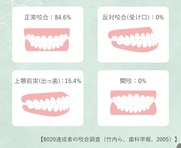 歯科矯正学 小児矯正MRC｜奈良の歯科・歯医者｜美希デンタルクリニック